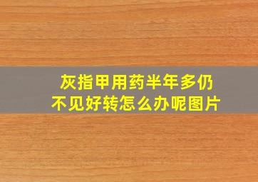 灰指甲用药半年多仍不见好转怎么办呢图片