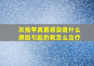 灰指甲真菌感染是什么原因引起的呢怎么治疗