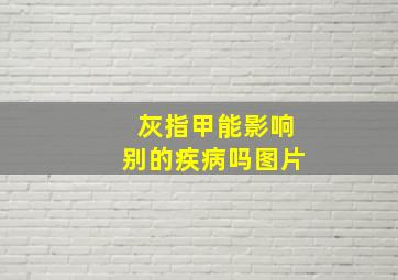 灰指甲能影响别的疾病吗图片