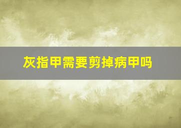 灰指甲需要剪掉病甲吗