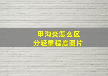 甲沟炎怎么区分轻重程度图片