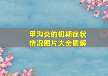 甲沟炎的初期症状情况图片大全图解