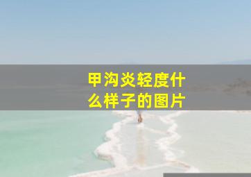 甲沟炎轻度什么样子的图片