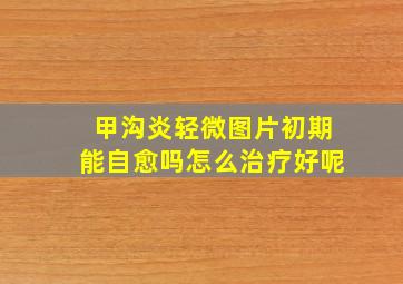 甲沟炎轻微图片初期能自愈吗怎么治疗好呢