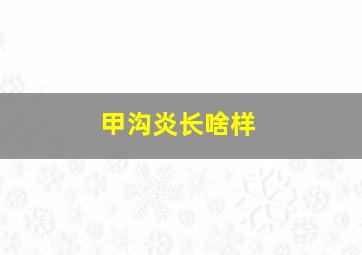 甲沟炎长啥样