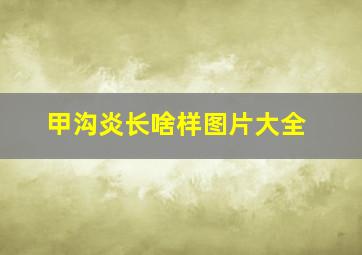 甲沟炎长啥样图片大全