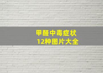 甲醛中毒症状12种图片大全