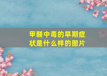 甲醛中毒的早期症状是什么样的图片