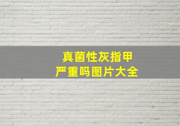 真菌性灰指甲严重吗图片大全