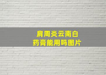 肩周炎云南白药膏能用吗图片