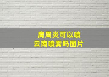 肩周炎可以喷云南喷雾吗图片