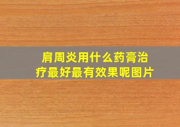 肩周炎用什么药膏治疗最好最有效果呢图片