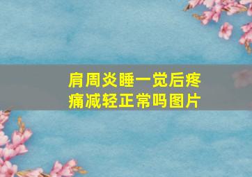 肩周炎睡一觉后疼痛减轻正常吗图片