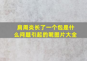 肩周炎长了一个包是什么问题引起的呢图片大全