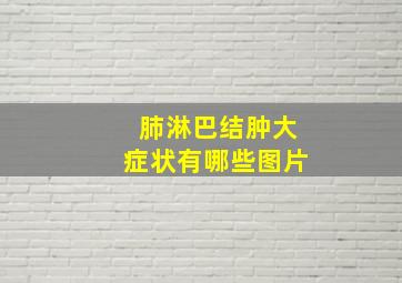 肺淋巴结肿大症状有哪些图片