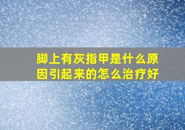 脚上有灰指甲是什么原因引起来的怎么治疗好