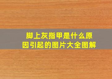 脚上灰指甲是什么原因引起的图片大全图解