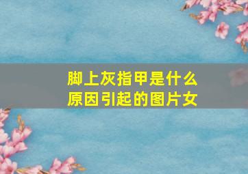 脚上灰指甲是什么原因引起的图片女