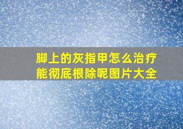 脚上的灰指甲怎么治疗能彻底根除呢图片大全