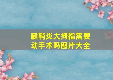 腱鞘炎大拇指需要动手术吗图片大全