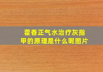 藿香正气水治疗灰指甲的原理是什么呢图片