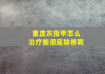 重度灰指甲怎么治疗能彻底除根呢