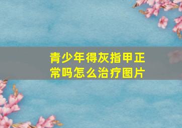 青少年得灰指甲正常吗怎么治疗图片