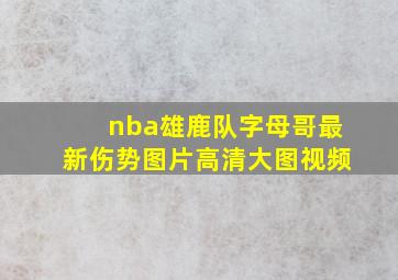 nba雄鹿队字母哥最新伤势图片高清大图视频