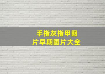 手指灰指甲图片早期图片大全