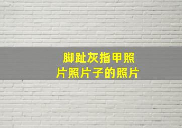 脚趾灰指甲照片照片子的照片